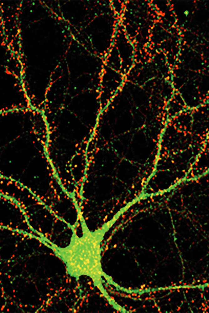 neuron-leadstory.jpg